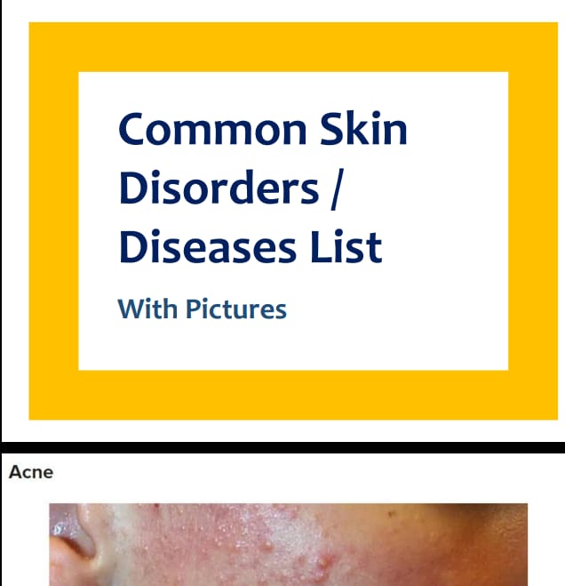 Skin-Disorders-Names